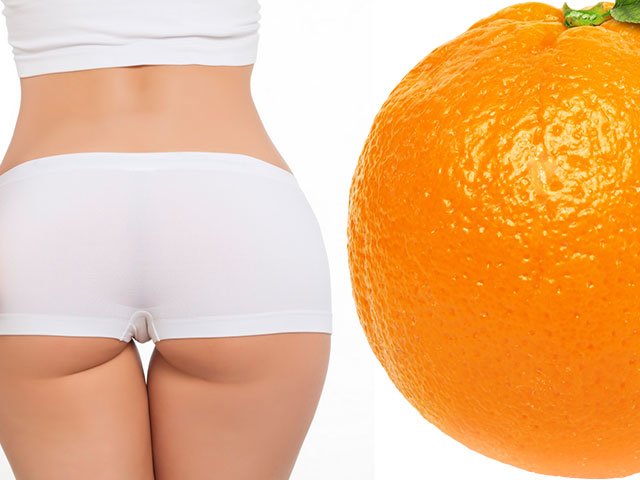 Methods for getting rid of cellulite