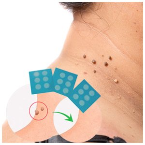 Papillary patches Formu Clear