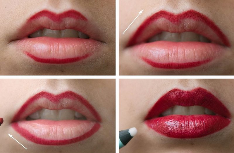 Lip contouring