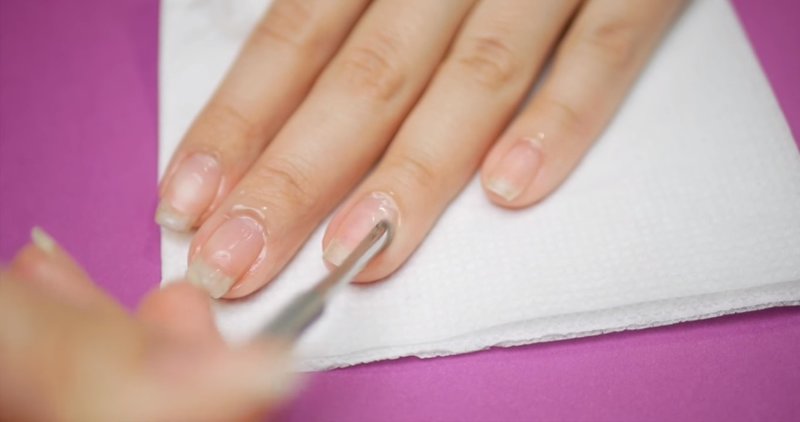 Cuticle removal