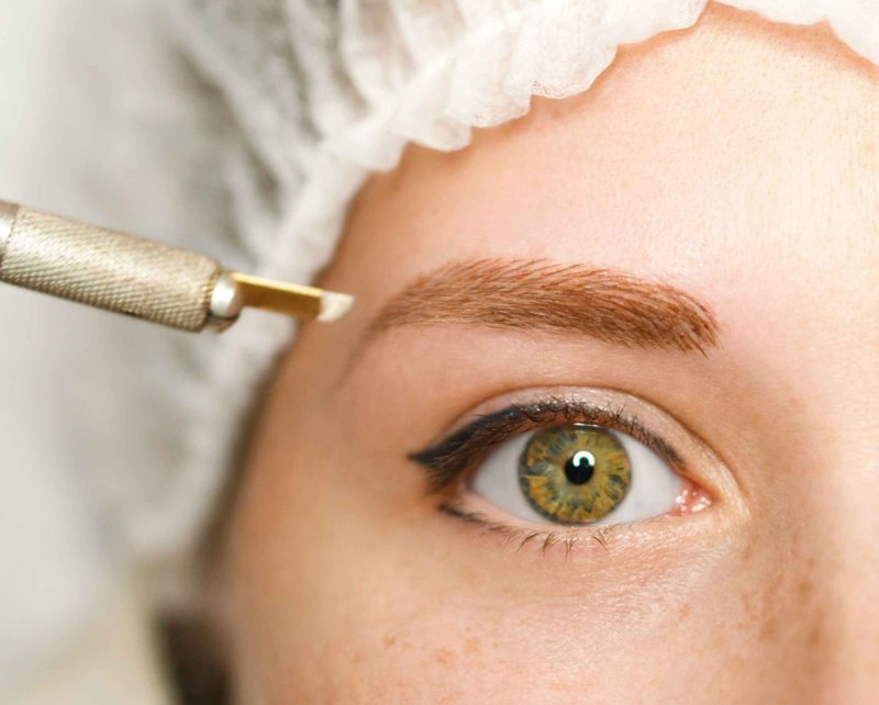 Contraindications to eyebrow tattooing