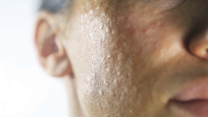 Papules with a diameter of 1 mm on the face