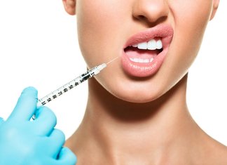 Lip filler injection