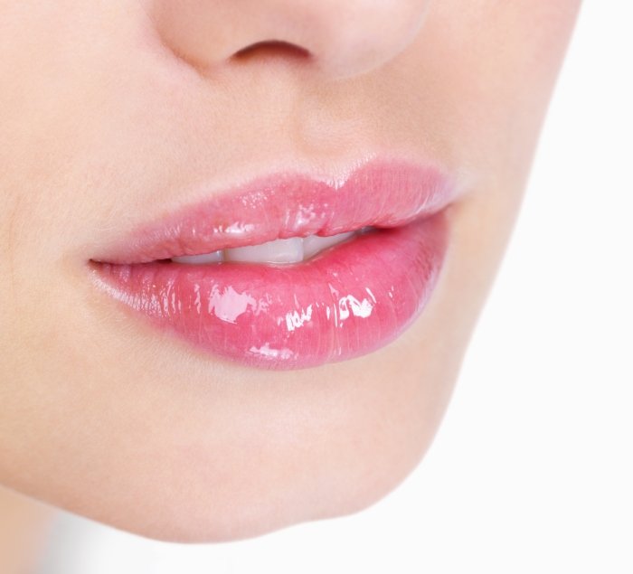 Lips after hyaluronic acid injection