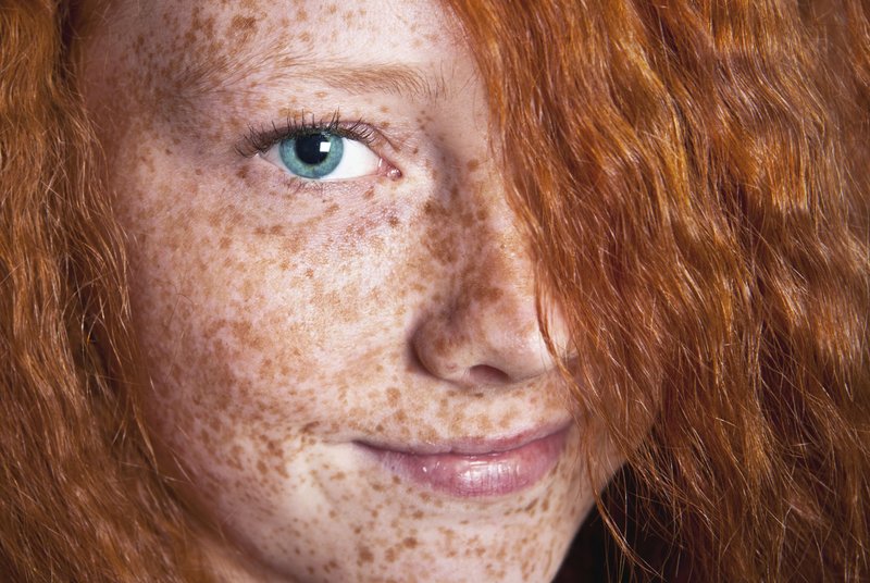 Girl with freckles on her face.