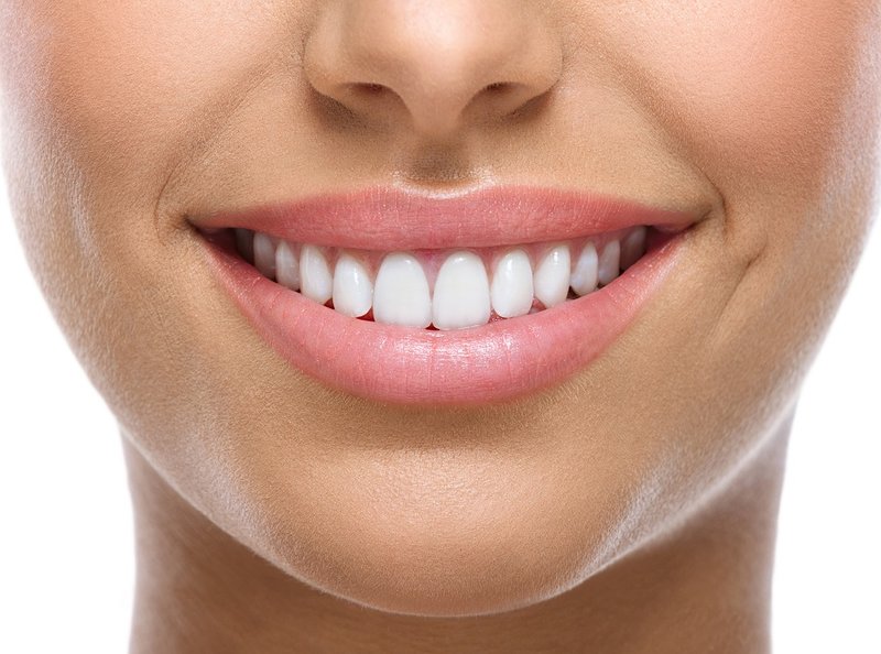 Smile with Perfect Smile Veneers