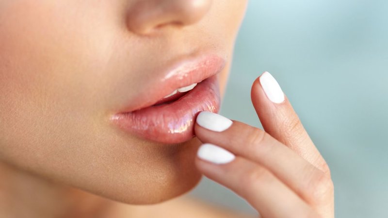 Prevention of bruising on the lips after enlargement