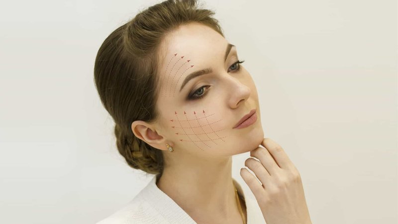 What is the expected effect of a facelift with threads?