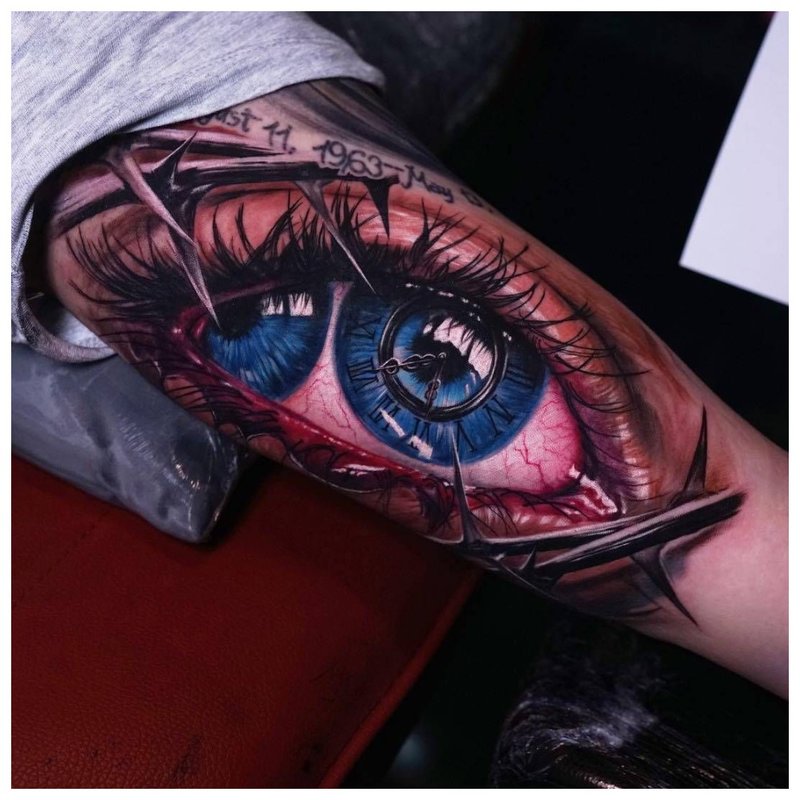 Eye with two irises